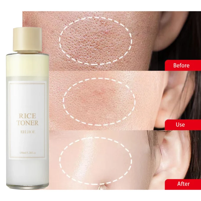 I’m From Rice Toner 150ml - Image 9